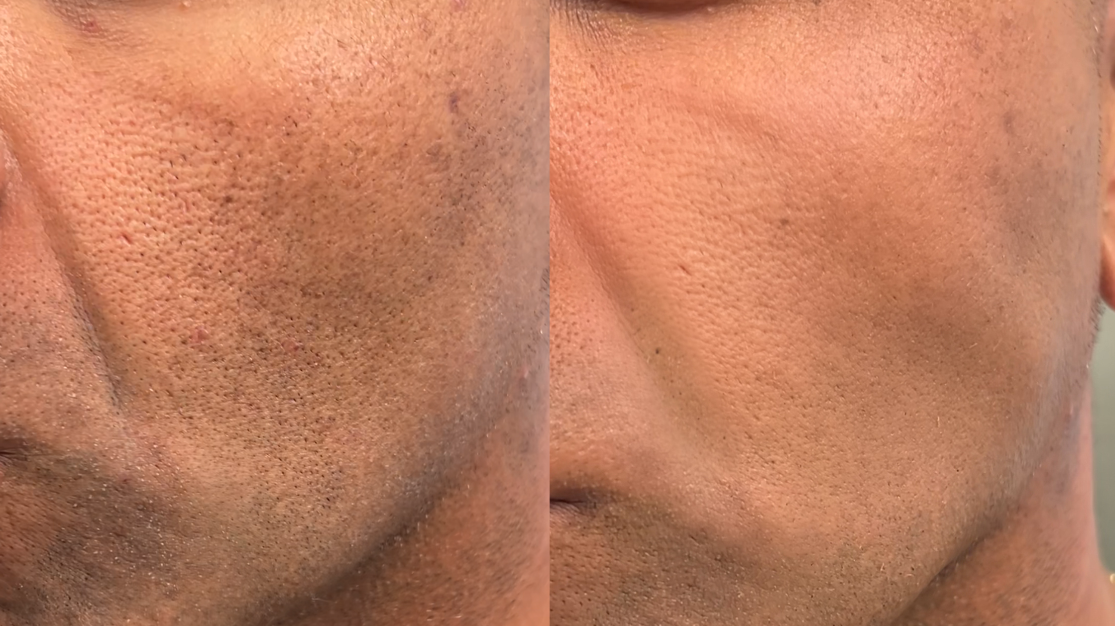 Men’s Concealer: Why It's Becoming a Staple In Men's Grooming Routines. Everything You Need to Know.