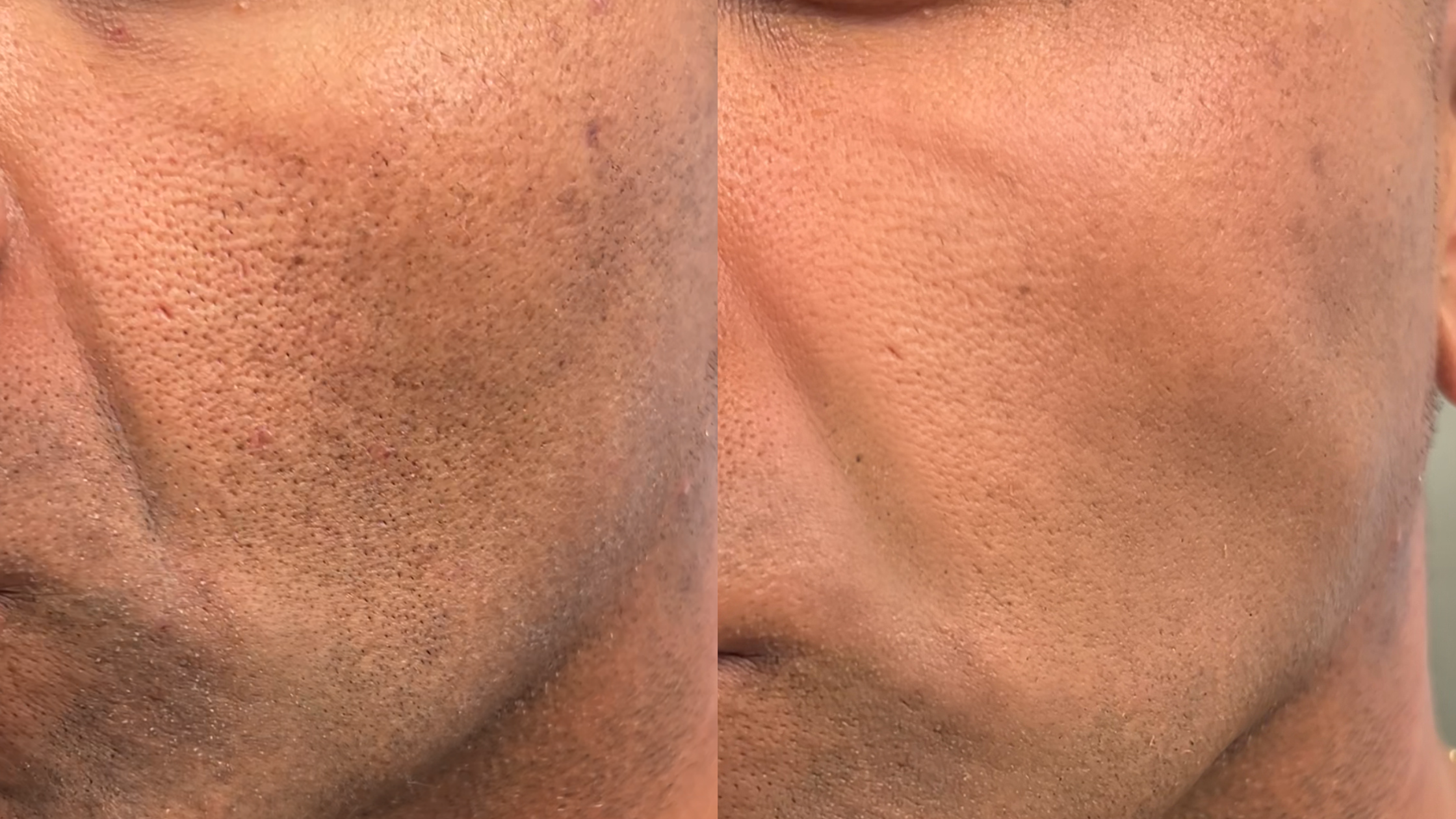 Men’s Concealer: Why It's Becoming a Staple In Men's Grooming Routines. Everything You Need to Know.