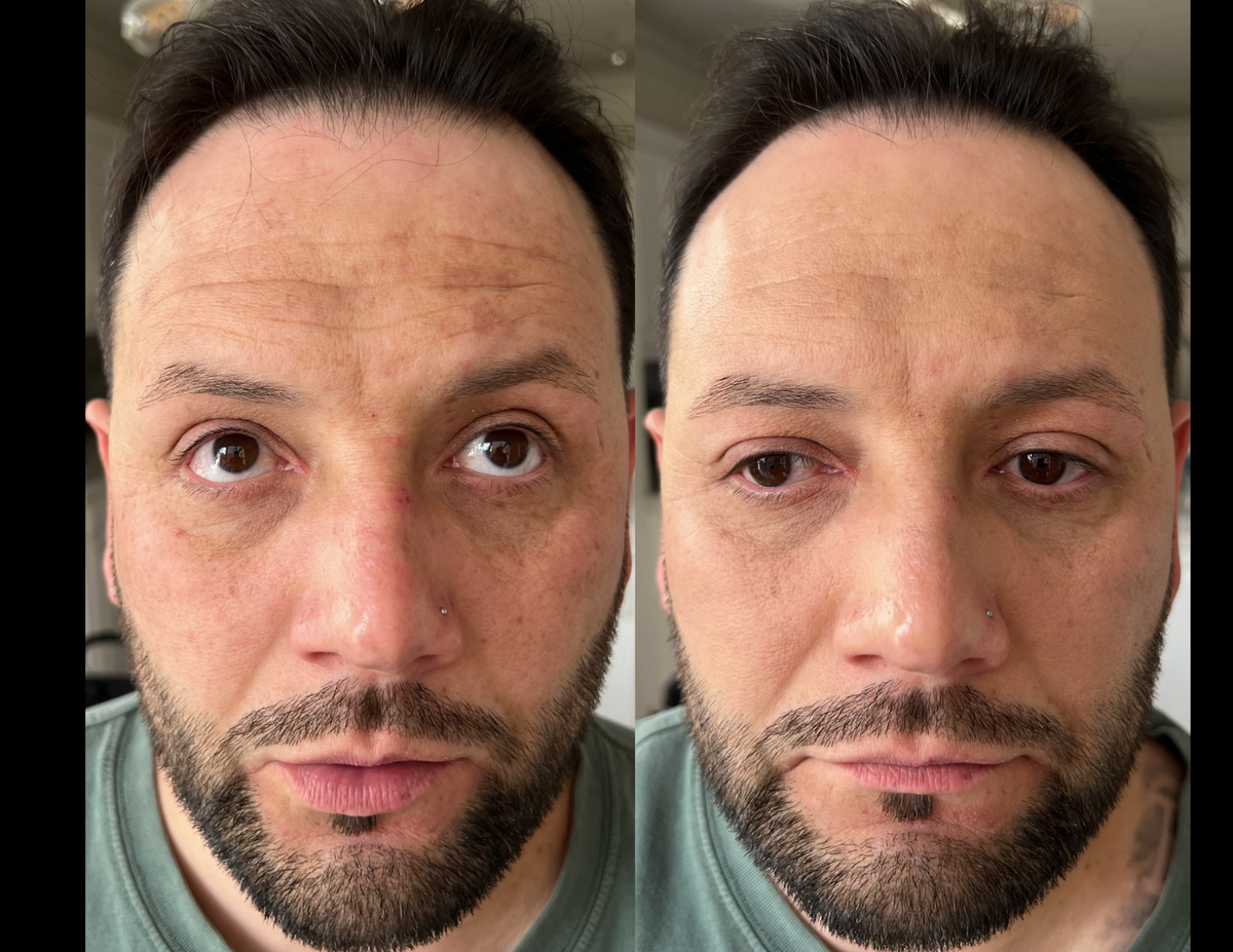 Before and after photos of the same man, side by side