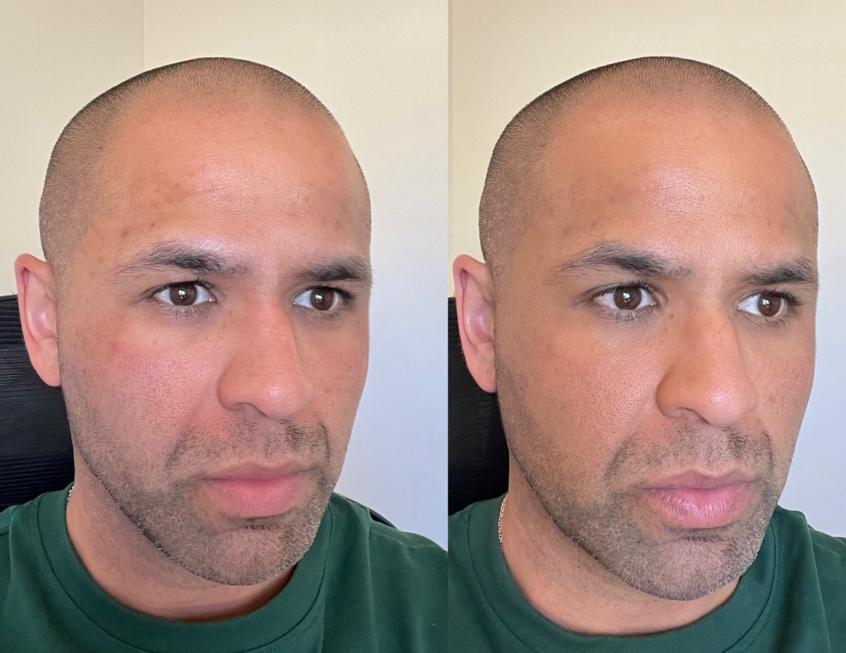 Before and after photos of the same man, side by side