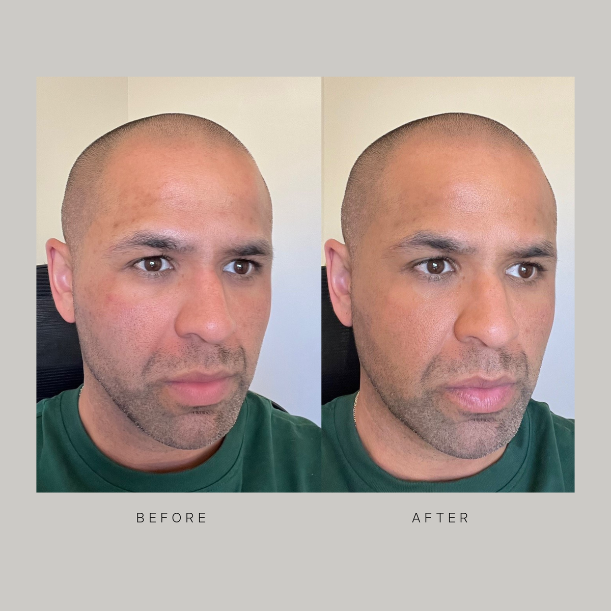 Real before and after photos of a man wearing Stealth Blender