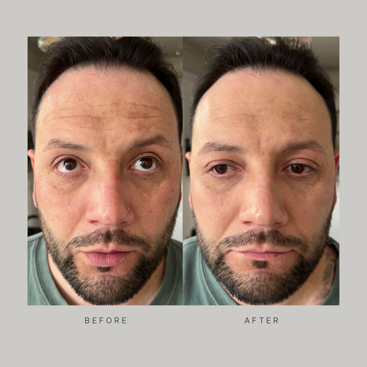 Real before and after photos of a bearded man wearing Stealth Blender